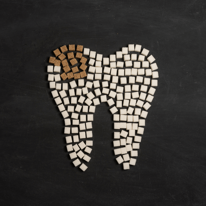 Caries dental ¡el enemigo invisible de tu sonrisa!