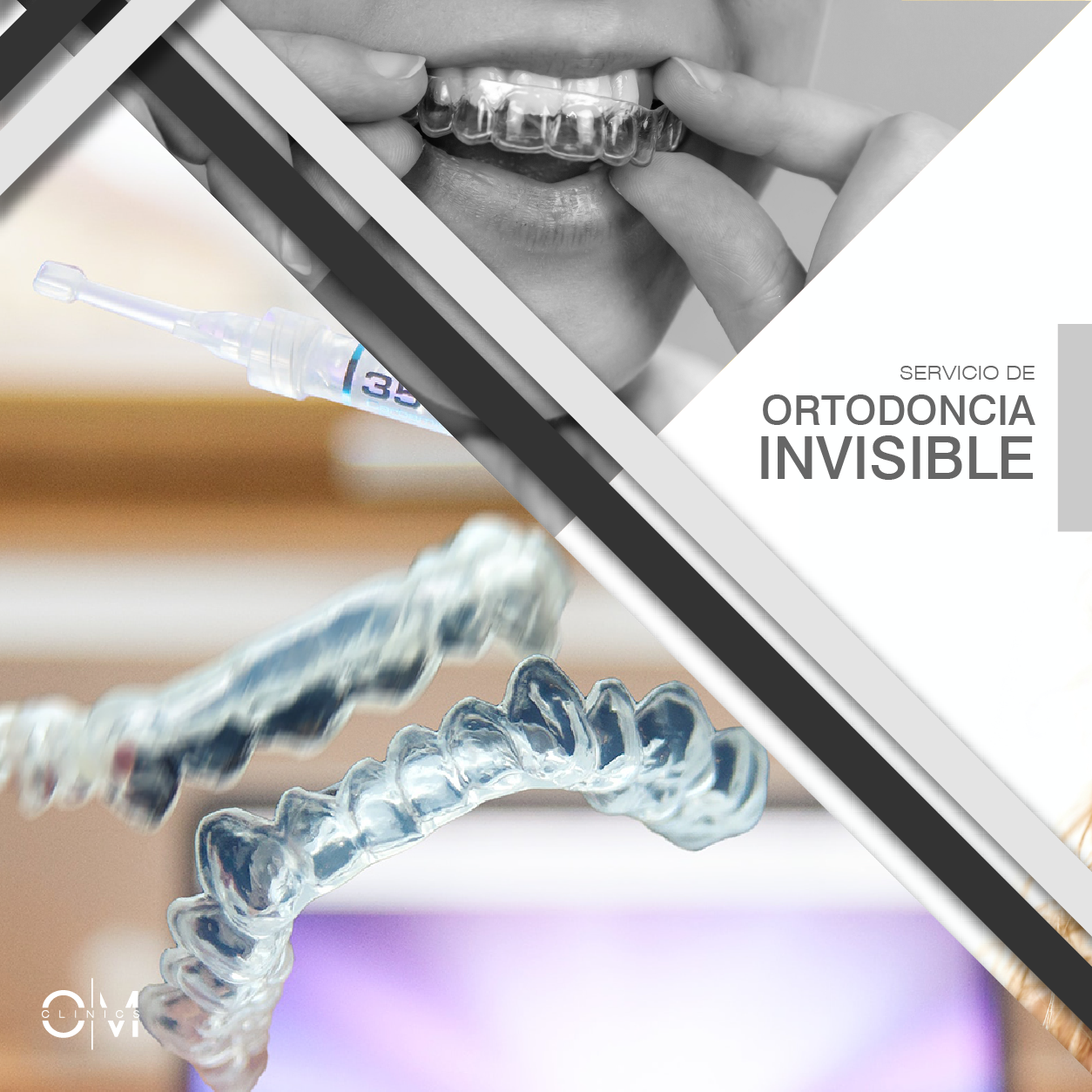 No toda la ortodoncia invisible es de Invisalign.